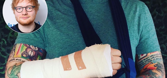 Ed Sheeran, accidente en bicicleta y tour en riesgo