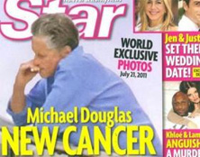 El tabaco supera a Michael Douglas