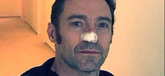 Hugh Jackman, otra operacin por el cncer de piel: Estoy bien, cuidado con el sol!