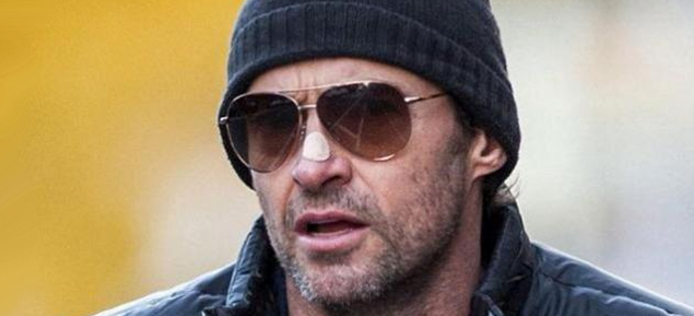 Hugh Jackman y su tratamiento contra el cncer